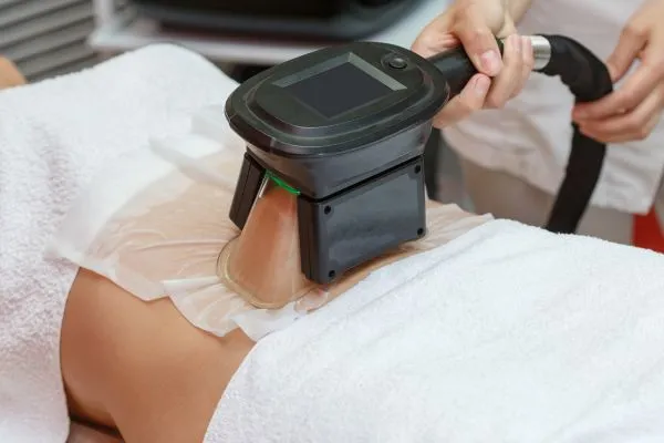 Image of person having fat freezing treatment to help weight gain Soho