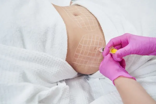 image of fat dissolving injections on love handles to help combat weight gain Soho