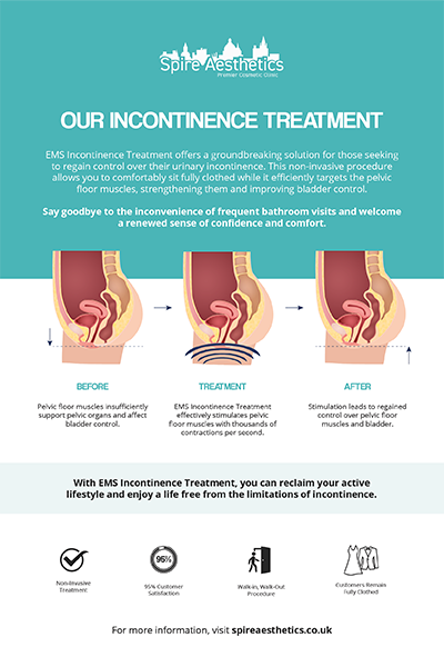 image to show how EMS treatment works for female urinary incontinence Soho